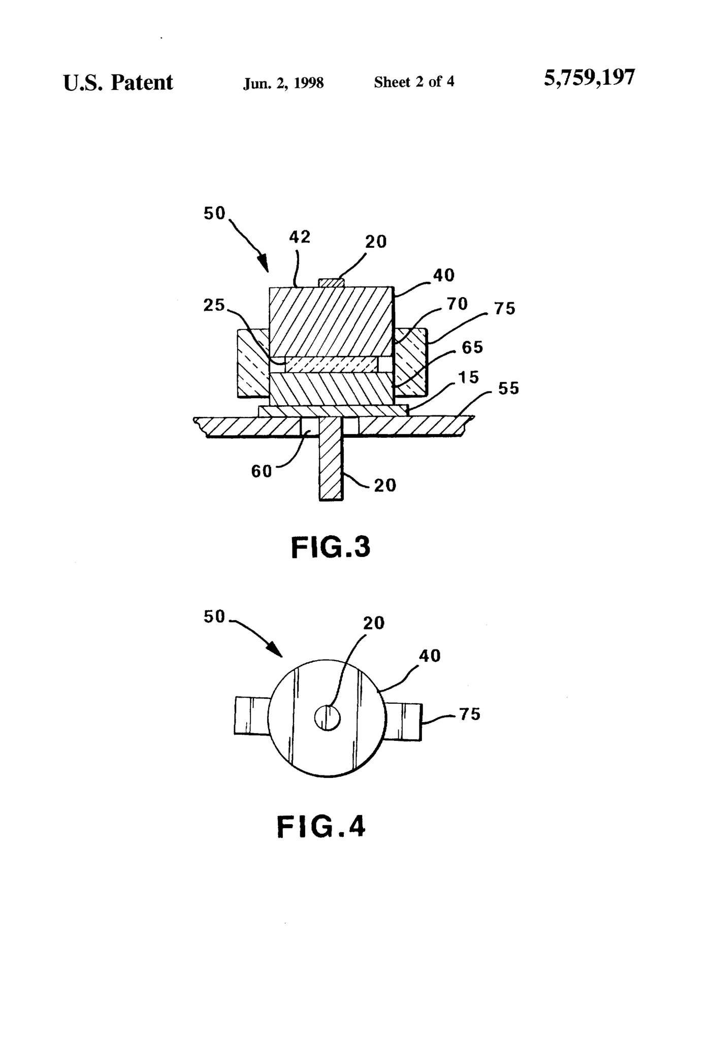 Cross-sectional view (FIG. 3) of the protective feedthrough: a conductor pin passes through an insulator-filled ferrule sealed in the case, while a flat chip capacitor bridges the gap between the ferrule's upstanding rim and the skirt of the conductive block above it.