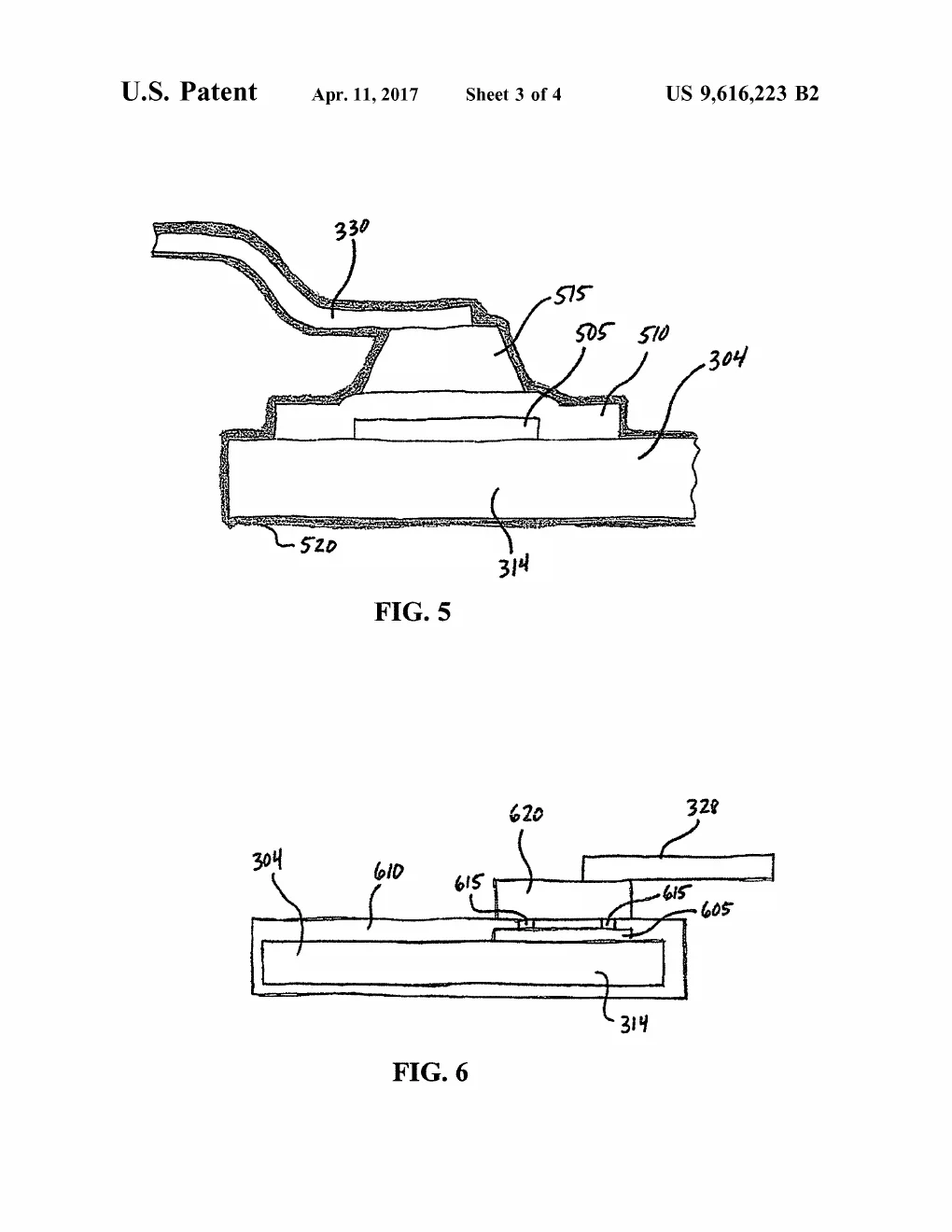 Cross-section of the exposed connection: layered metal draped over the sensor contact, built to face body fluids directly.