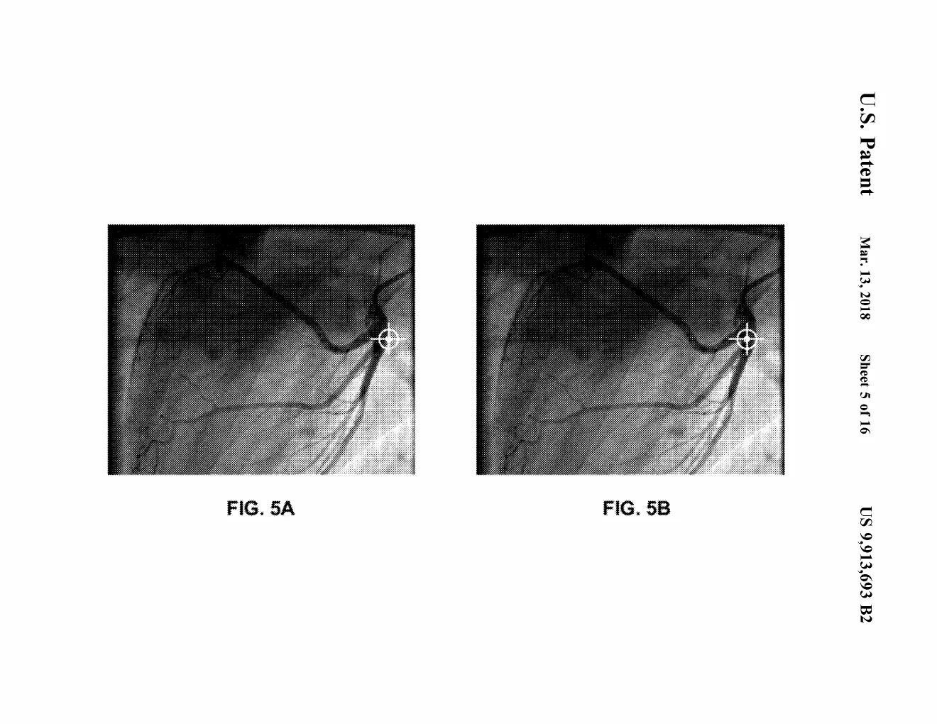 Two angiogram images from the patent itself, a crosshair marking the tracked instrument's position on the heart.